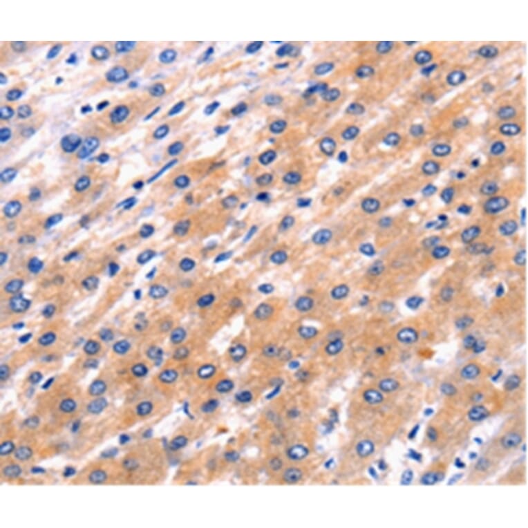 Immunohistochemistry - RAB39 Antibody from Signalway Antibody (36737) - Antibodies.com