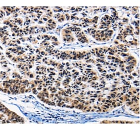 Immunohistochemistry - AP1B1 Antibody from Signalway Antibody (36740) - Antibodies.com