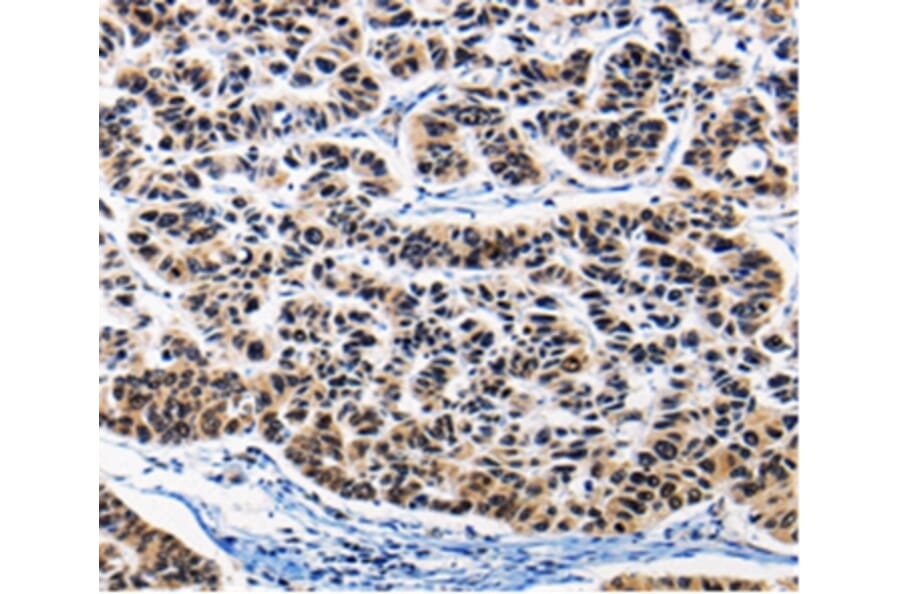 Immunohistochemistry - AP1B1 Antibody from Signalway Antibody (36740) - Antibodies.com
