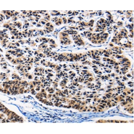 Immunohistochemistry - AP1B1 Antibody from Signalway Antibody (36740) - Antibodies.com