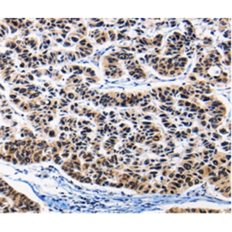 Immunohistochemistry - AP1B1 Antibody from Signalway Antibody (36740) - Antibodies.com