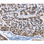 Immunohistochemistry - AP1B1 Antibody from Signalway Antibody (36740) - Antibodies.com