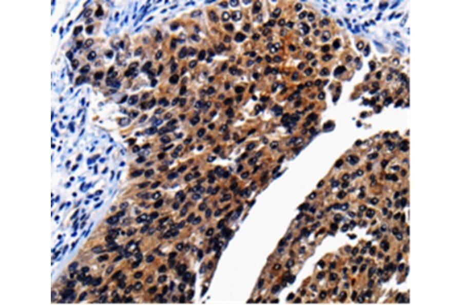 Immunohistochemistry - AP1B1 Antibody from Signalway Antibody (36740) - Antibodies.com
