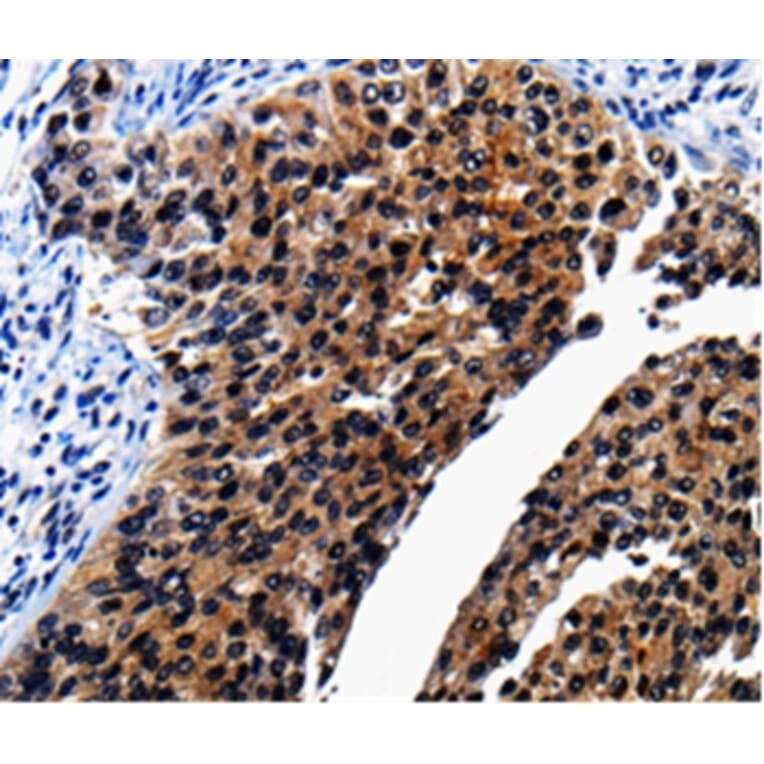 Immunohistochemistry - AP1B1 Antibody from Signalway Antibody (36740) - Antibodies.com