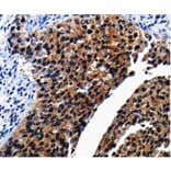 Immunohistochemistry - AP1B1 Antibody from Signalway Antibody (36740) - Antibodies.com