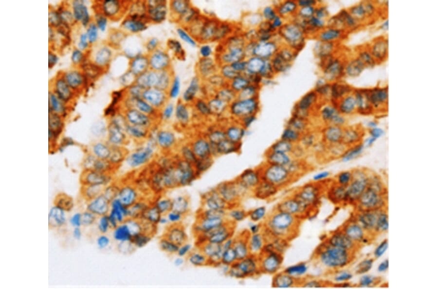 Immunohistochemistry - AP1G1 Antibody from Signalway Antibody (36741) - Antibodies.com