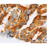 Immunohistochemistry - AP1G1 Antibody from Signalway Antibody (36741) - Antibodies.com