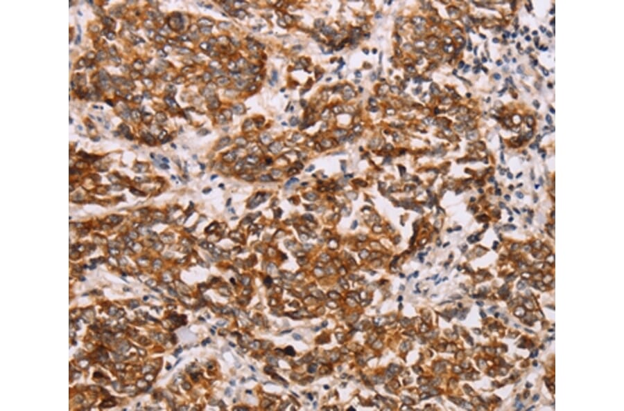 Immunohistochemistry - RAB3D Antibody from Signalway Antibody (36746) - Antibodies.com
