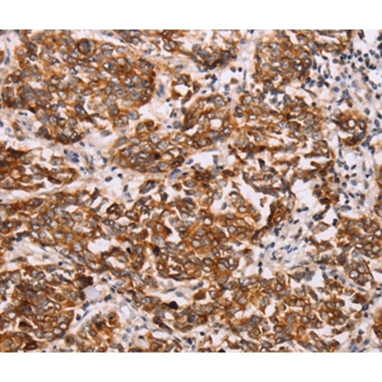 Immunohistochemistry - RAB3D Antibody from Signalway Antibody (36746) - Antibodies.com