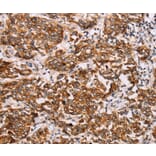 Immunohistochemistry - RAB3D Antibody from Signalway Antibody (36746) - Antibodies.com