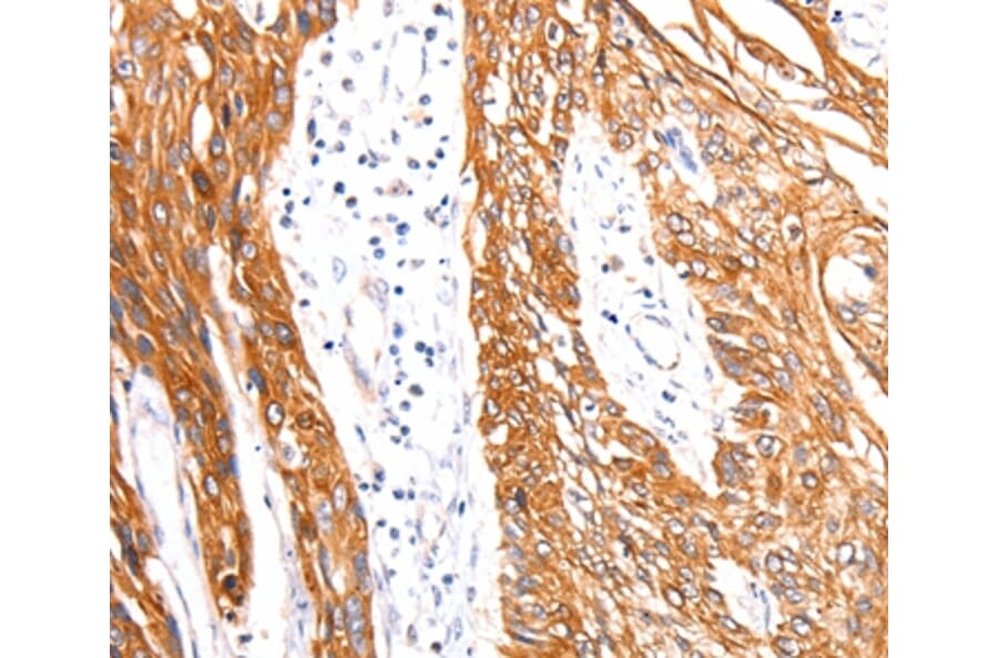 Immunohistochemistry - RAB3D Antibody from Signalway Antibody (36746) - Antibodies.com