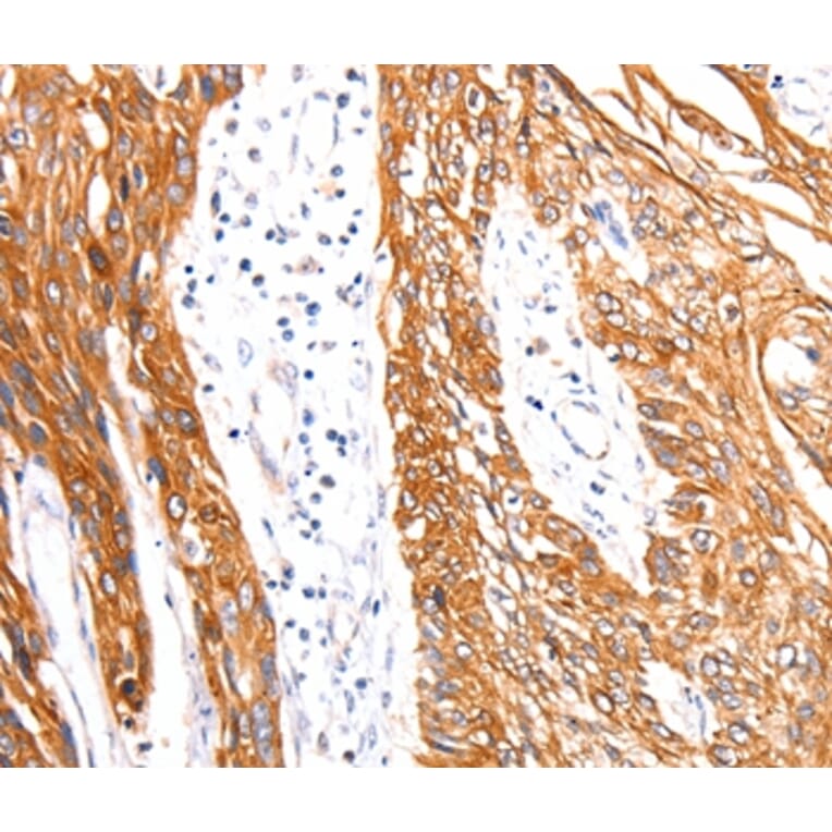 Immunohistochemistry - RAB3D Antibody from Signalway Antibody (36746) - Antibodies.com