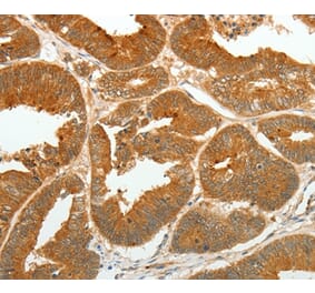 Immunohistochemistry - ASCL1 Antibody from Signalway Antibody (36763) - Antibodies.com