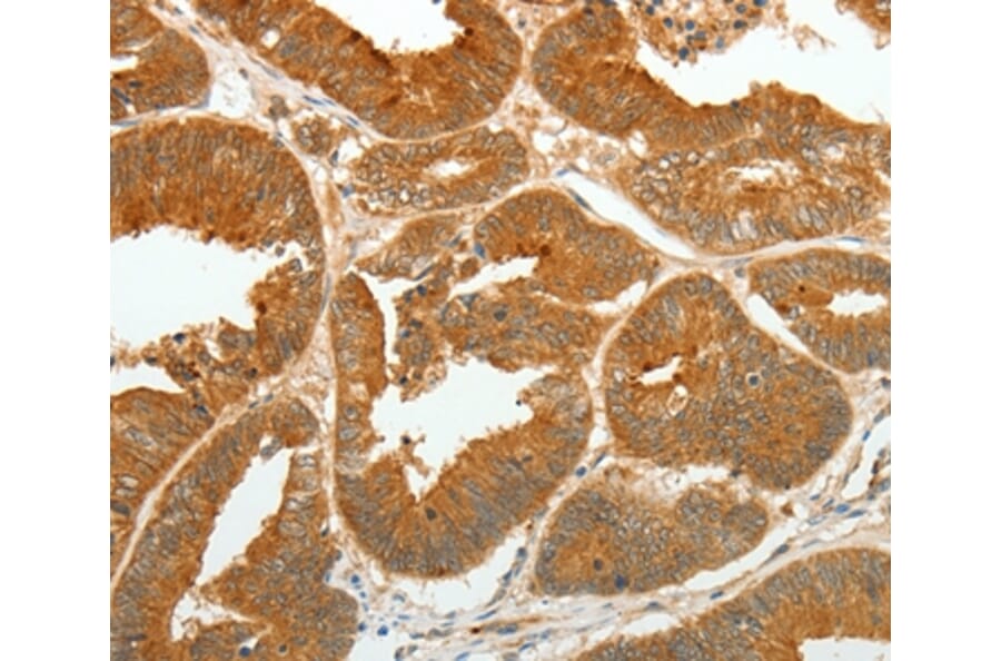 Immunohistochemistry - ASCL1 Antibody from Signalway Antibody (36763) - Antibodies.com