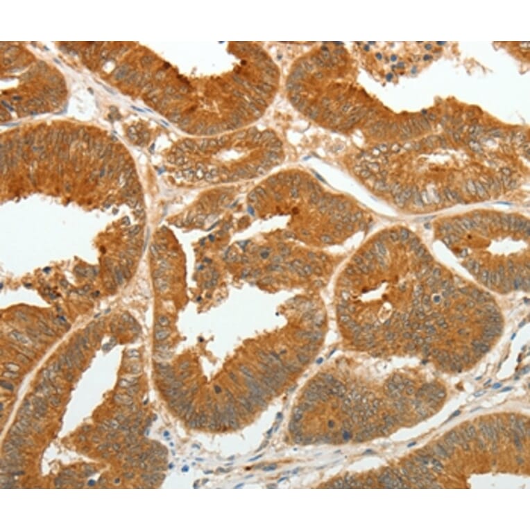 Immunohistochemistry - ASCL1 Antibody from Signalway Antibody (36763) - Antibodies.com