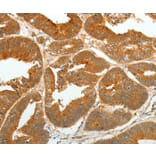Immunohistochemistry - ASCL1 Antibody from Signalway Antibody (36763) - Antibodies.com
