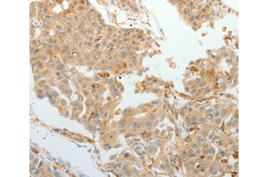 Immunohistochemistry - ASCL1 Antibody from Signalway Antibody (36763) - Antibodies.com