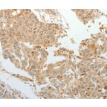 Immunohistochemistry - ASCL1 Antibody from Signalway Antibody (36763) - Antibodies.com
