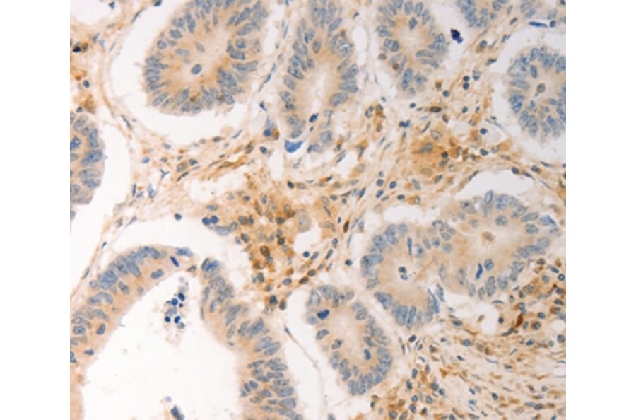 Immunohistochemistry - AVPR2 Antibody from Signalway Antibody (36765) - Antibodies.com