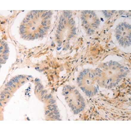 Immunohistochemistry - AVPR2 Antibody from Signalway Antibody (36765) - Antibodies.com