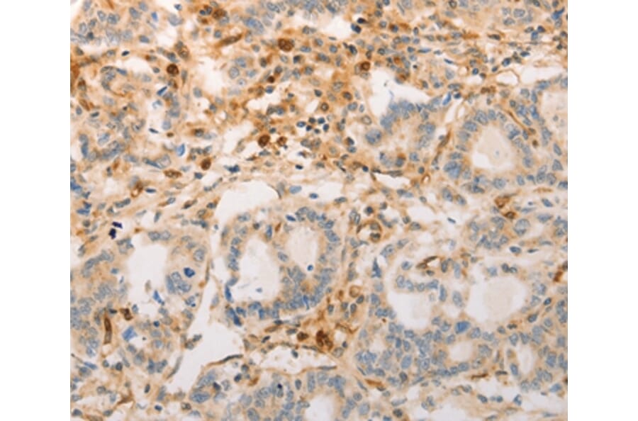 Immunohistochemistry - AVPR2 Antibody from Signalway Antibody (36765) - Antibodies.com