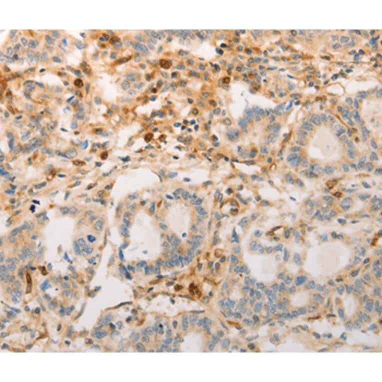 Immunohistochemistry - AVPR2 Antibody from Signalway Antibody (36765) - Antibodies.com