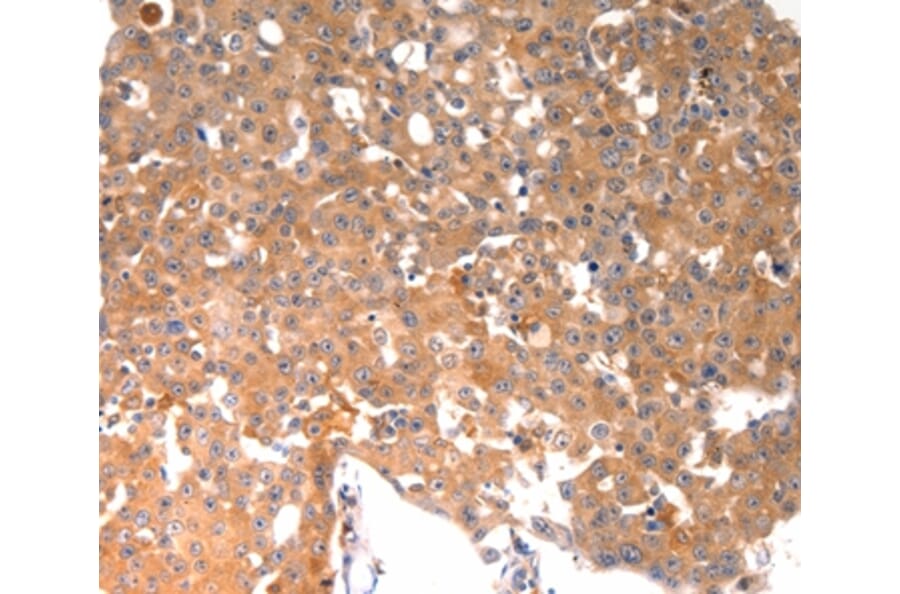Immunohistochemistry - BGLAP Antibody from Signalway Antibody (36774) - Antibodies.com