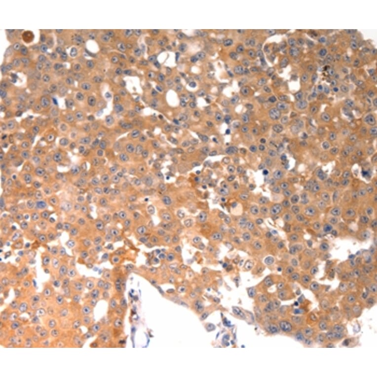 Immunohistochemistry - BGLAP Antibody from Signalway Antibody (36774) - Antibodies.com