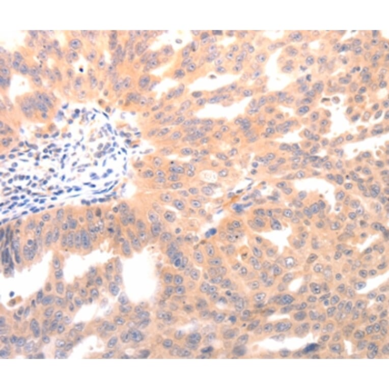Immunohistochemistry - BGLAP Antibody from Signalway Antibody (36774) - Antibodies.com