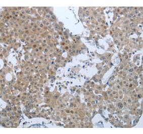 Immunohistochemistry - CCL15 Antibody from Signalway Antibody (36782) - Antibodies.com