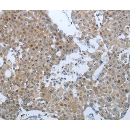 Immunohistochemistry - CCL15 Antibody from Signalway Antibody (36782) - Antibodies.com