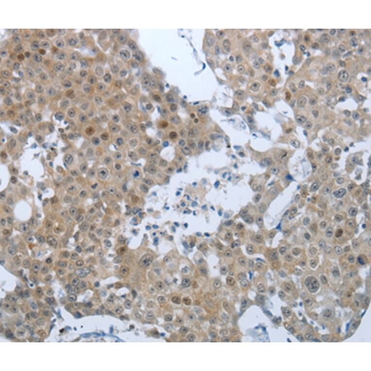 Immunohistochemistry - CCL15 Antibody from Signalway Antibody (36782) - Antibodies.com