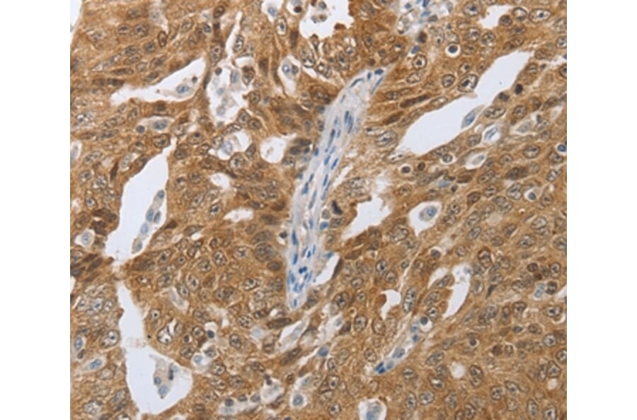 Immunohistochemistry - CEBPA Antibody from Signalway Antibody (36789) - Antibodies.com