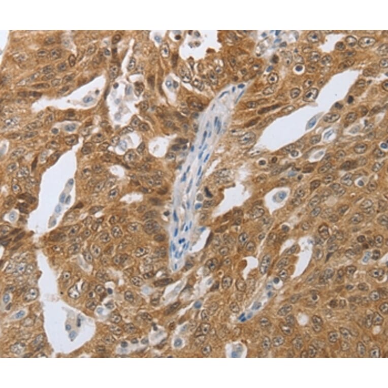 Immunohistochemistry - CEBPA Antibody from Signalway Antibody (36789) - Antibodies.com