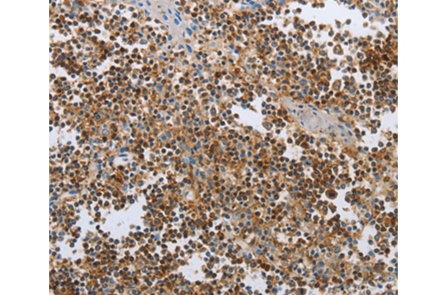 Immunohistochemistry - CEBPA Antibody from Signalway Antibody (36789) - Antibodies.com