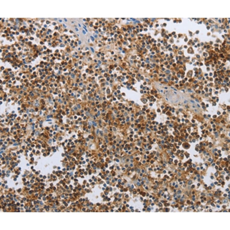 Immunohistochemistry - CEBPA Antibody from Signalway Antibody (36789) - Antibodies.com