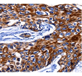 Immunohistochemistry - KRT10 Antibody from Signalway Antibody (36795) - Antibodies.com