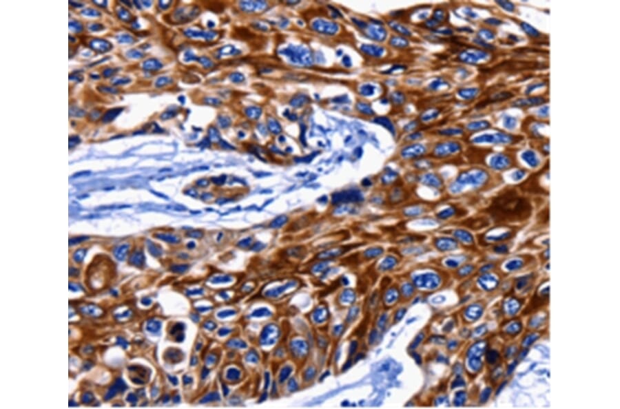 Immunohistochemistry - KRT10 Antibody from Signalway Antibody (36795) - Antibodies.com