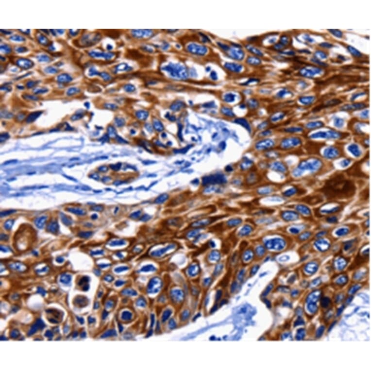 Immunohistochemistry - KRT10 Antibody from Signalway Antibody (36795) - Antibodies.com