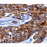 Immunohistochemistry - KRT10 Antibody from Signalway Antibody (36795) - Antibodies.com
