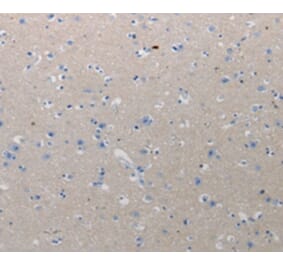 Immunohistochemistry - CMTM1 Antibody from Signalway Antibody (36796) - Antibodies.com