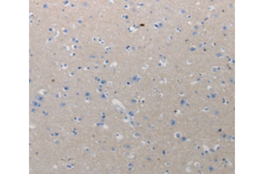 Immunohistochemistry - CMTM1 Antibody from Signalway Antibody (36796) - Antibodies.com