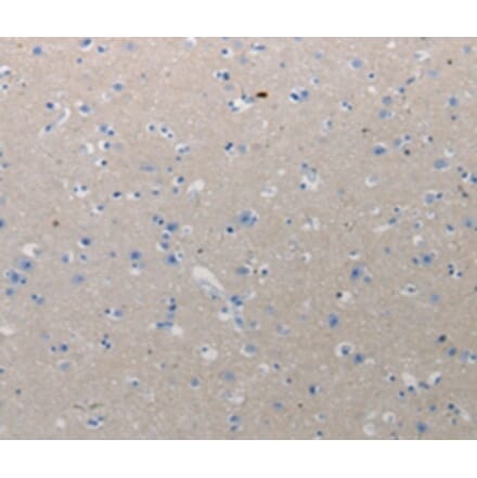 Immunohistochemistry - CMTM1 Antibody from Signalway Antibody (36796) - Antibodies.com