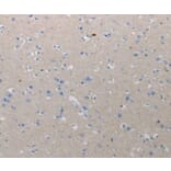 Immunohistochemistry - CMTM1 Antibody from Signalway Antibody (36796) - Antibodies.com