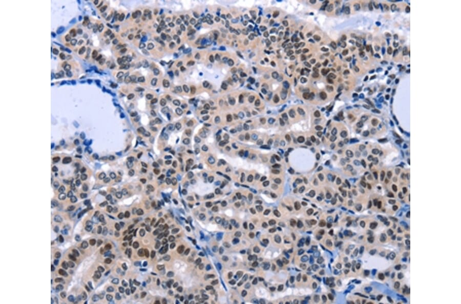 Immunohistochemistry - COX18 Antibody from Signalway Antibody (36801) - Antibodies.com