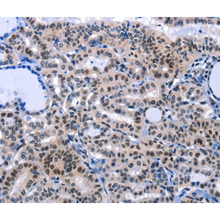 Immunohistochemistry - COX18 Antibody from Signalway Antibody (36801) - Antibodies.com