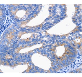 Immunohistochemistry - CTLA4 Antibody from Signalway Antibody (36808) - Antibodies.com