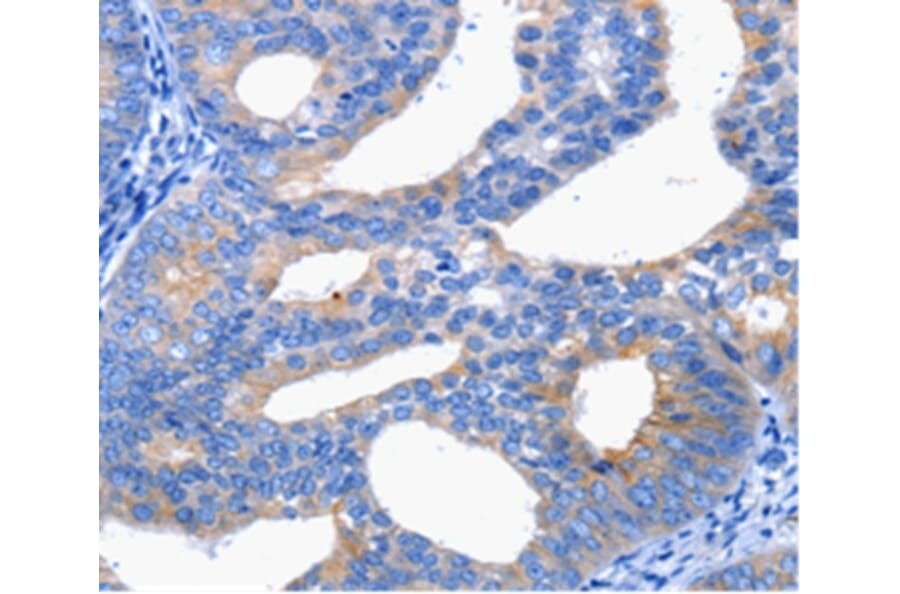 Immunohistochemistry - CTLA4 Antibody from Signalway Antibody (36808) - Antibodies.com