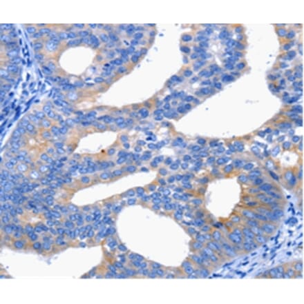 Immunohistochemistry - CTLA4 Antibody from Signalway Antibody (36808) - Antibodies.com