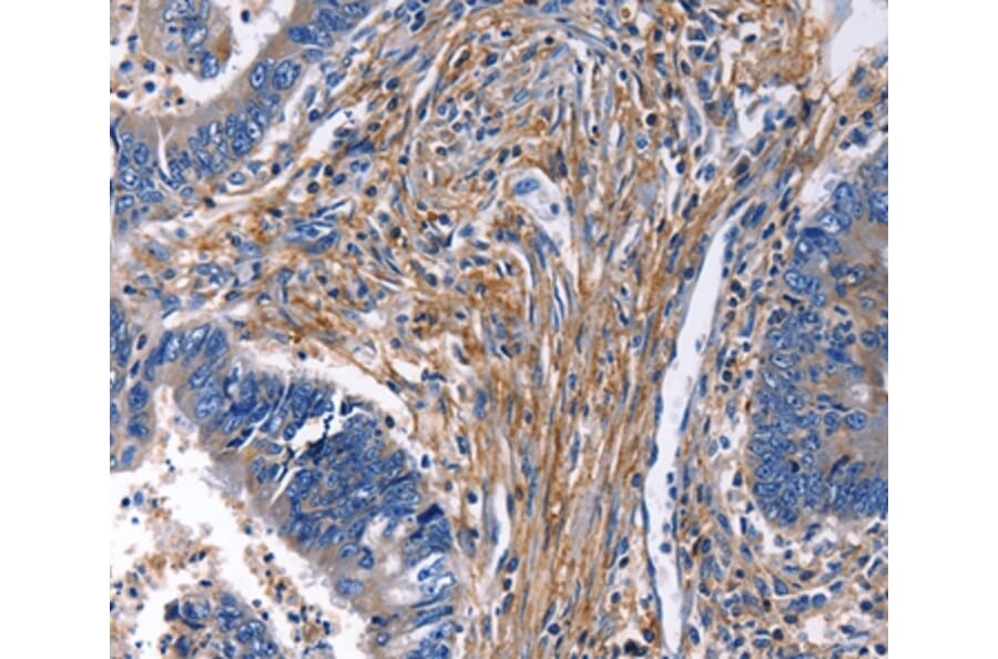 Immunohistochemistry - CXCR5 Antibody from Signalway Antibody (36815) - Antibodies.com